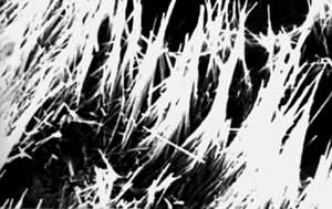 ������΢���°���ʯ�ľ�����״