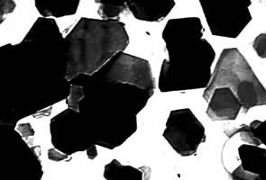 ����ʯ(������΢������Ƭ16 000X)