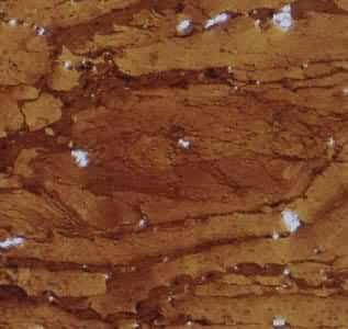 ��΢ú����֡�����Ƥ�塡����ƫ��Ŵ�180X�����أ��㽭����