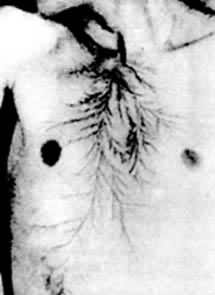 �׻�����ʬ���ϵ���֦״�׻���