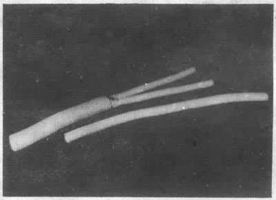 ֱ�ͺ�Ѿ������Ѫ��