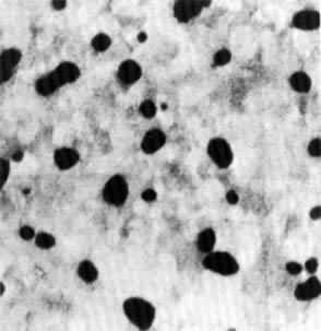 ͼ1  �������ڻ���̿�ϵ�͸��羵��Ƭ