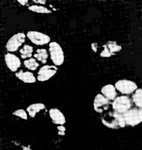 ͼ2  �������ĵ�����΢����Ƭ