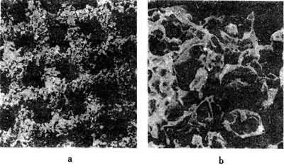 ������ɨ��羵��Ƭ  a�Ŵ�40��  b�Ŵ�375��