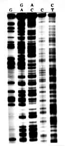 ͼ3 ��Ҭ�˻�Ҷ�����½������������DNA����