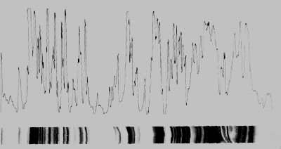 ͼ4 �����ø�Ƽ������㣨50΢�ף������ȵ�۽��͹��ܶ�ɨ��ͼ��