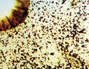 ͼ ���͹��̢�