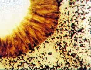 ͼ ���͹��̢�