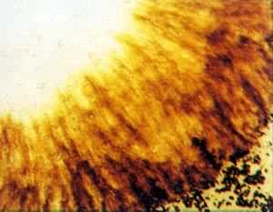 ͼ ���͹��̢�