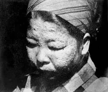 ���������ж�֢״