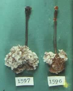 �������շ���С��ǰθ��ͷ�����걾