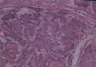 �������շ���С��ǰθ��ͷ������΢ͼ��