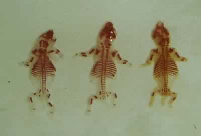 农药敌枯双诱发的大鼠胎仔骨骼畸形　左、右：颅骨缺损、多肋。中：颅骨缺损、短肋、颅骨融合