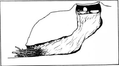 �����Ļ���ѨҤ��������ַ3��Ҥ����ԭʾ��ͼ