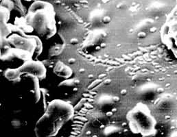 �����ש��ɨ�������΢���2500��ͼ�а�ɫ��״��Ϊ��б�����