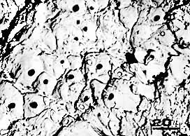 ͼ7���ֵ����ԶϿڵ���΢��֯