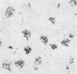 ͼ1����״ʯī�Ľ�����Ƭ��δ��ʴ ��100