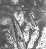 ͼ7��Fe-25Ni-0.3V-0.3C ���е������弰����Χ�İ�����