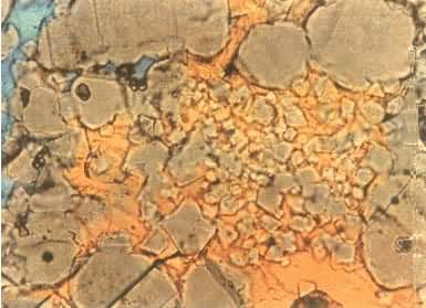 þ��ש��͸�䡢����ƫ���450����þʯ������ɫԲ��״���е��н�����þ���⾧ʯ������ɫ�����С���壻�����Ρ�����ɫ����ɫ����