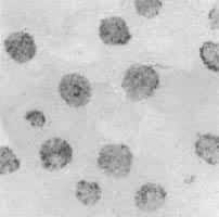 ͼ1����״ʯī�Ľ�����Ƭδ��ʴ��100