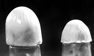 ͼ3 ����ͷ����ʴ���γɵ�������Ш