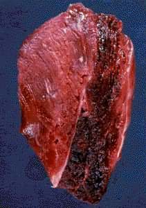 ţ���׾Ҽ��ⲡ��