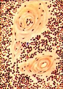 ��Ƣ�����붯���ڵ�͸������