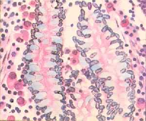 ��С����Ƥ��ճҺ����