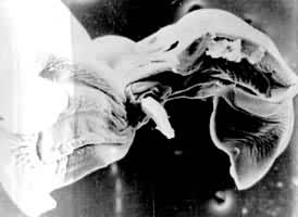 ��תѪì�߳��۳�β�˽���ɡ