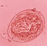 �ڳ�����������ʬ�м�����ձ�Ѫ������