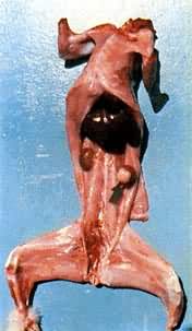 ������ĸϸ����