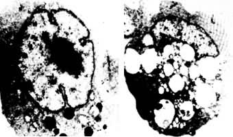 ͼ2 ������΢���µ������ѳ�ϸ�� �� ����ϸ�� �� ���������Ĳ�����ϸ��