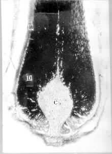 ͼ2��ë���²��Ĺ�����̬����Ƥ��A ë����B ë���ʡ�C ë��ͷ��D ë��