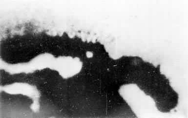 ͼ10 ������˫����Ⱦɫ���һ������ë���ִ����໷