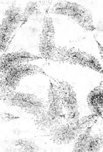 ͼ2����������ĸϸ���н����һ���ֺ�����˿���ĵĵ�����΢����Ƭ