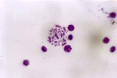 �ۼ���Ⱦɫ��