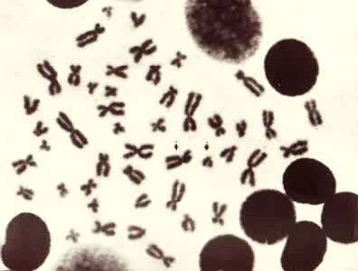 ���˵ĺ��ͣ���ͷ��ָΪ��Ⱦɫ�壬����ΪXȾɫ�壬С��ΪYȾɫ��