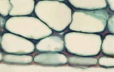 ������Ҷ���ĺ����֯