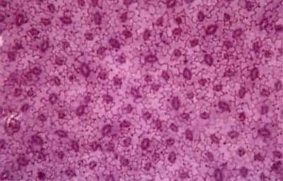 ������Ҷ��Ƥ��ʾ����