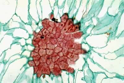 �����ʯϸ��