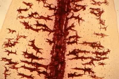 �޺���ʯϸ��