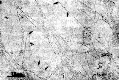 ͼ6��Ⱦɫ�ʵĸ�����Ƭ��ʾ��DNA���ƺ�С��Ҳ����ͬʱ����