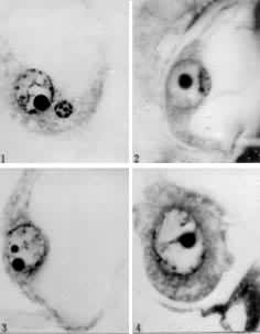 ͼ5���޻�������ϵļ���ʱ�ڡ�1.�������Ѻ��ԡ�2��3.�������Ѻ����ں��С�4.�����ڷ���ǰ��