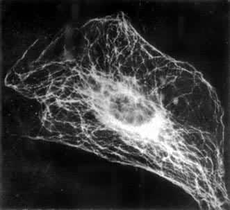 ͼ2��ϸ����΢�ܵ��׿�������ӫ��Ⱦɫ��ʾ�������д�ϸһ�µ�΢����