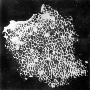 ͼ4����ƽ���������׿�������ӫ��Ⱦɫ��ʾ����ļ�������Z�̱�Ե��λ�ᵰ�׷ֲ�