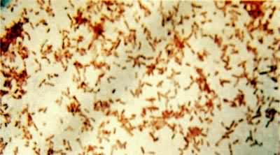 �󳦸˾���������Ⱦɫ����