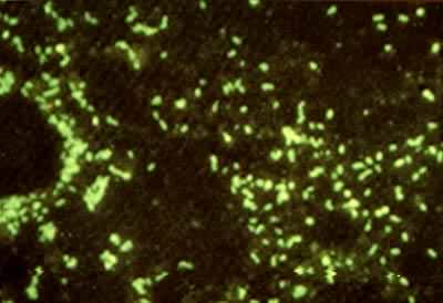 �ȷ��Ծ��ž����ܵ��������ľ��Ų�