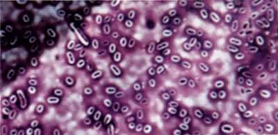 ���׿��ϸ˾�����������һ���Ĥ