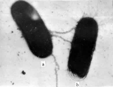 ͼ1��ϸ���Ӻϵĵ羵���ࣨ46200��a ����ϸ��������������ɡë�ϸ���������MS2�ɾ��� b ����ϸ��