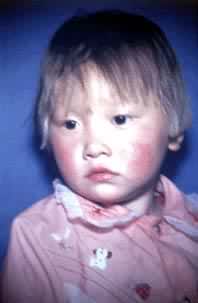 ����ͪ��֢����